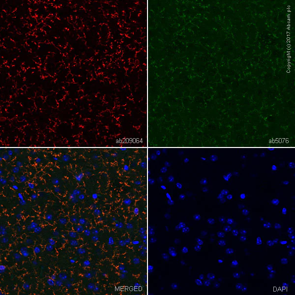 Immunohistochemistry (Formalin/PFA-fixed paraffin-embedded sections) - Anti-TMEM119 antibody [28-3] - Microglial marker - BSA and Azide free (AB234501)