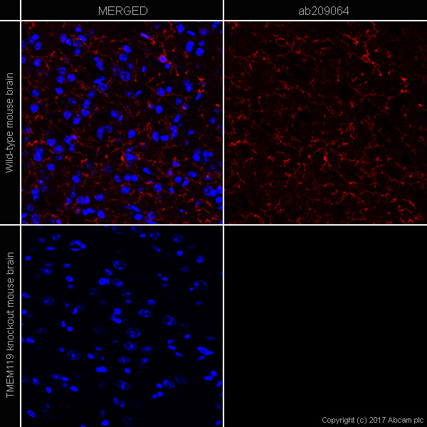 Immunohistochemistry (Frozen sections) - Anti-TMEM119 antibody [28-3] - Microglial marker - BSA and Azide free (AB234501)