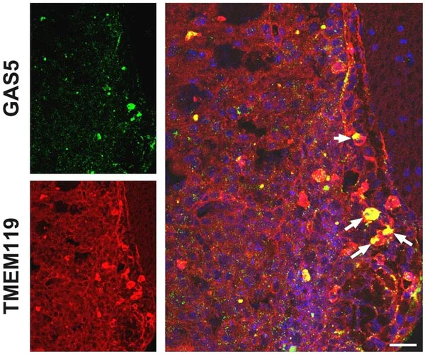 Immunohistochemistry (Frozen sections) - Anti-TMEM119 antibody [28-3] - Microglial marker - BSA and Azide free (AB234501)