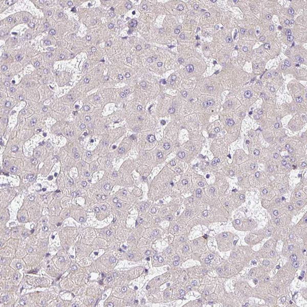 Immunohistochemistry (Formalin/PFA-fixed paraffin-embedded sections) - Anti-TMEM119 antibody - C-terminal (AB185333), expandable thumbnail