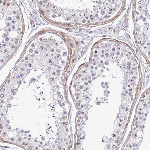 Immunohistochemistry (Formalin/PFA-fixed paraffin-embedded sections) - Anti-TMEM119 antibody - C-terminal - Microglial marker (AB185333)