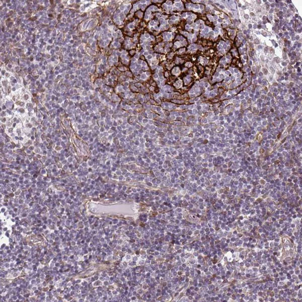Immunohistochemistry (Formalin/PFA-fixed paraffin-embedded sections) - Anti-TMEM119 antibody - C-terminal - Microglial marker (AB185333)