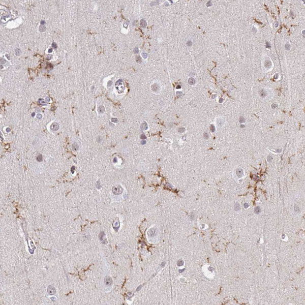 Immunohistochemistry (Formalin/PFA-fixed paraffin-embedded sections) - Anti-TMEM119 antibody - C-terminal (AB185333), expandable thumbnail