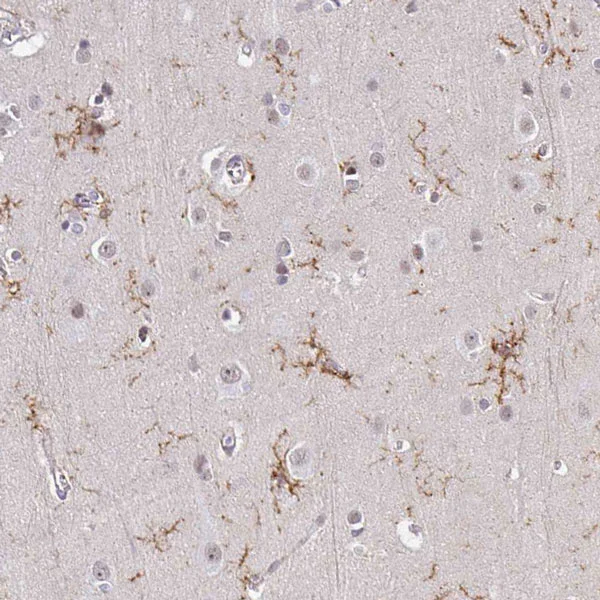Immunohistochemistry (Formalin/PFA-fixed paraffin-embedded sections) - Anti-TMEM119 antibody - C-terminal - Microglial marker (AB185333)