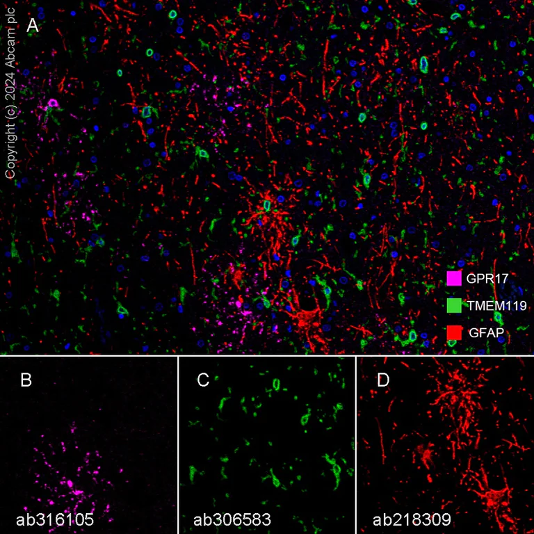 Multiplex immunohistochemistry - Anti-TMEM119 antibody [EPR25865-89] - BSA and Azide free (AB306584)