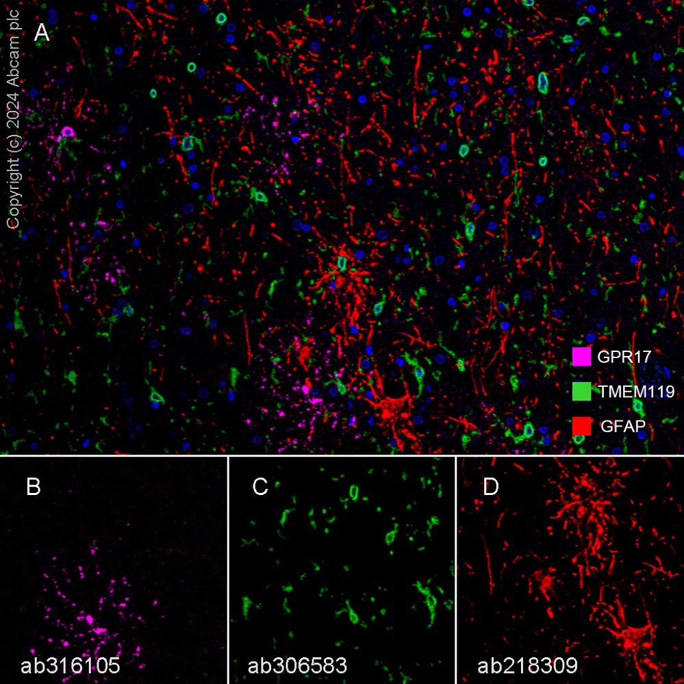 Multiplex immunohistochemistry - Anti-TMEM119 antibody [EPR25865-89] (AB306583), expandable thumbnail