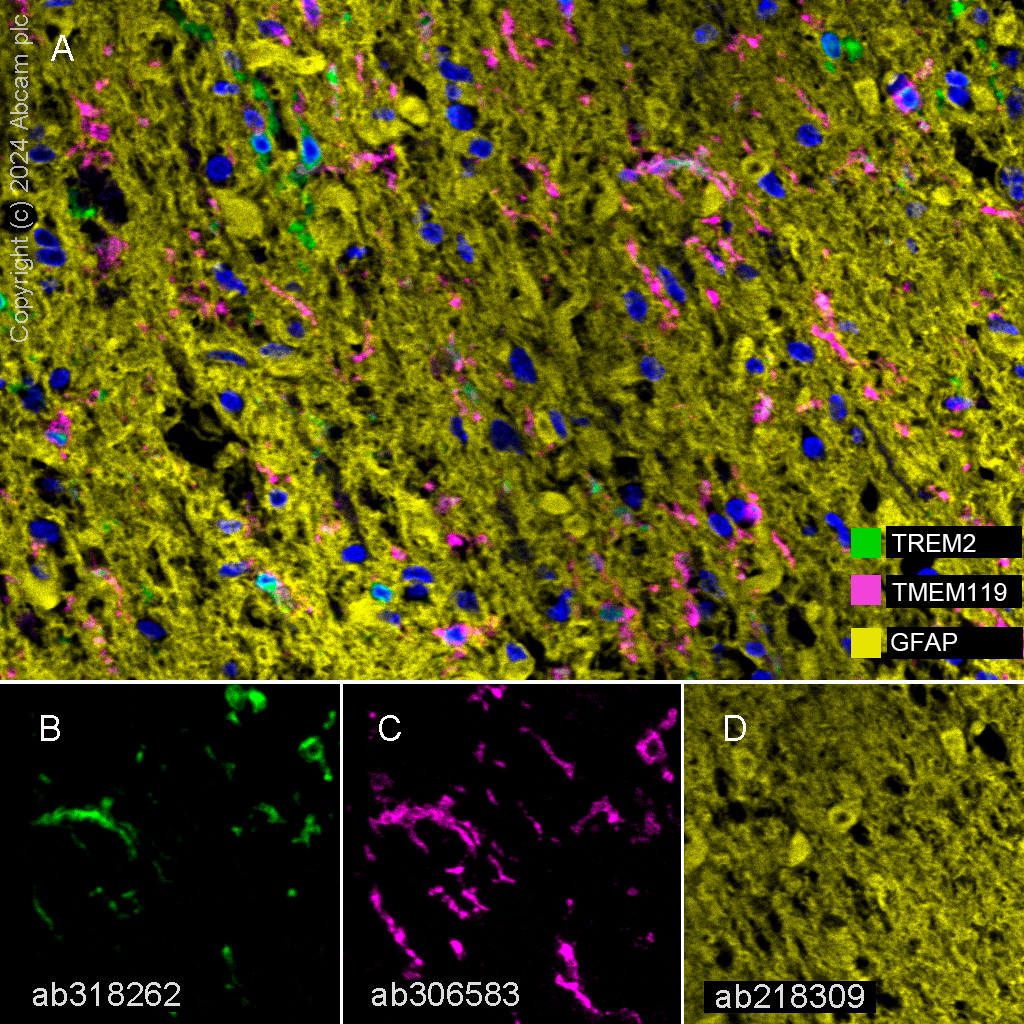 Multiplex immunohistochemistry - Anti-TMEM119 antibody [EPR25865-89] (AB306583), expandable thumbnail