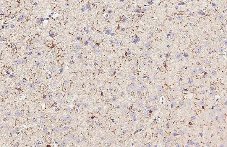 Immunohistochemistry (Formalin/PFA-fixed paraffin-embedded sections) - Anti-TMEM119 antibody [HL2415] (AB317220)