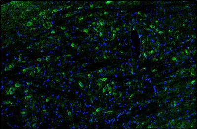 Immunohistochemistry (Formalin/PFA-fixed paraffin-embedded sections) - Anti-Tmem119 antibody [L128/43] - Chicken IgY (Chimeric) (AB325668)
