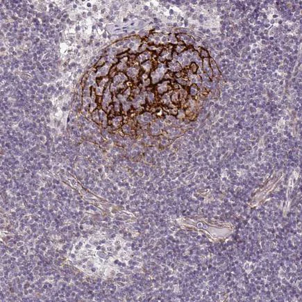 Immunohistochemistry (Formalin/PFA-fixed paraffin-embedded sections) - Anti-TMEM119 antibody - Microglial marker (AB185337)