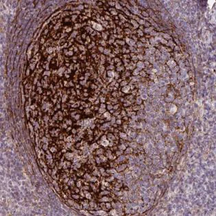 Immunohistochemistry (Formalin/PFA-fixed paraffin-embedded sections) - Anti-TMEM119 antibody - Microglial marker (AB185337)