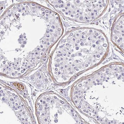 Immunohistochemistry (Formalin/PFA-fixed paraffin-embedded sections) - Anti-TMEM119 antibody - Microglial marker (AB185337)