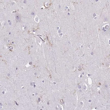 Immunohistochemistry (Formalin/PFA-fixed paraffin-embedded sections) - Anti-TMEM119 antibody - Microglial marker (AB185337)