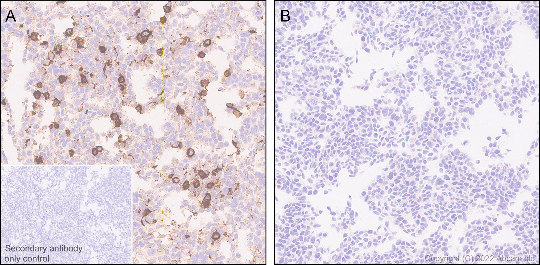 Immunohistochemistry (Formalin/PFA-fixed paraffin-embedded sections) - Anti-TMEM119 antibody [RM1075] - BSA and Azide free (AB314915), expandable thumbnail