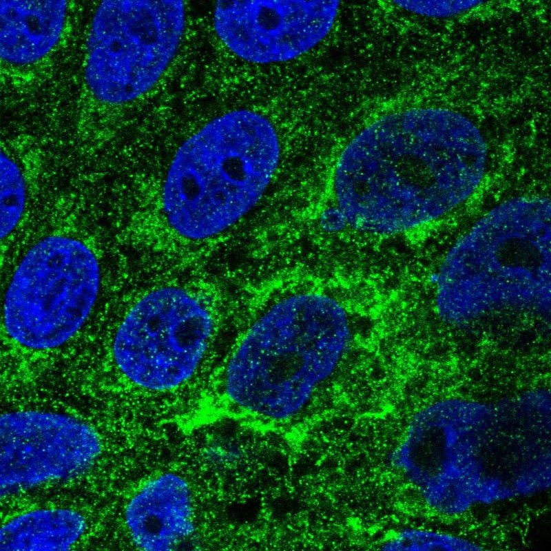 Immunocytochemistry/ Immunofluorescence - Anti-TMEM141 antibody (AB272567)