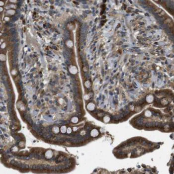 Immunohistochemistry (Formalin/PFA-fixed paraffin-embedded sections) - Anti-TMEM143 antibody (AB121431)