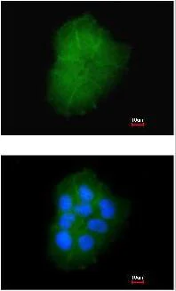 Immunocytochemistry/ Immunofluorescence - Anti-TMEM147 antibody (AB97624)