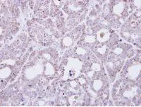 Immunohistochemistry (Formalin/PFA-fixed paraffin-embedded sections) - Anti-TMEM147 antibody (AB97624)