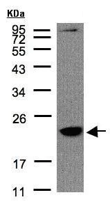 Western blot - Anti-TMEM147 antibody (AB97624)