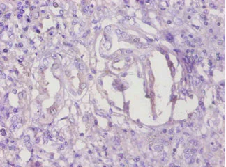 Immunohistochemistry (Formalin/PFA-fixed paraffin-embedded sections) - Anti-TMEM14B antibody (AB193198)