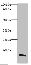 Western blot - Anti-TMEM14B antibody (AB193198)