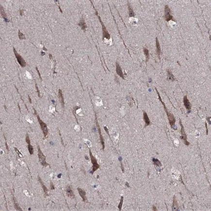 Immunohistochemistry (Formalin/PFA-fixed paraffin-embedded sections) - Anti-TMEM151A antibody (AB243580)
