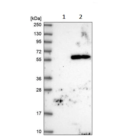 Western blot - Anti-TMEM151A antibody (AB243580)