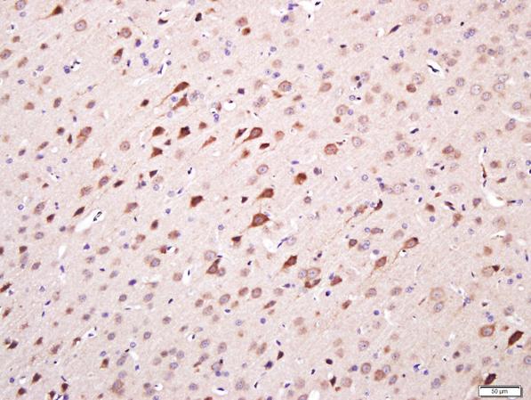 Immunohistochemistry (Formalin/PFA-fixed paraffin-embedded sections) - Anti-TMEM158 antibody (AB213691), expandable thumbnail