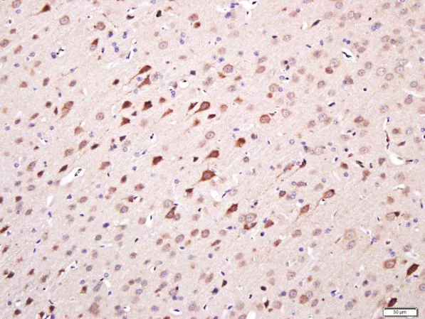 Immunohistochemistry (Formalin/PFA-fixed paraffin-embedded sections) - Anti-TMEM158 antibody (AB213691)