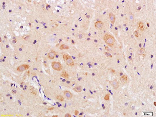 Immunohistochemistry (Formalin/PFA-fixed paraffin-embedded sections) - Anti-TMEM158 antibody (AB213691)