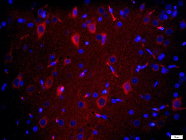 Immunohistochemistry (Formalin/PFA-fixed paraffin-embedded sections) - Anti-TMEM158 antibody (AB213691), expandable thumbnail