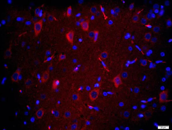 Immunohistochemistry (Formalin/PFA-fixed paraffin-embedded sections) - Anti-TMEM158 antibody (AB213691)