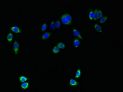 Immunocytochemistry/ Immunofluorescence - Anti-TMEM161A antibody (AB237533)