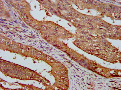 Immunohistochemistry (Formalin/PFA-fixed paraffin-embedded sections) - Anti-TMEM161A antibody (AB237533)
