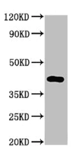 Western blot - Anti-TMEM161A antibody (AB237533)