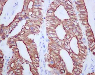 Immunohistochemistry (Formalin/PFA-fixed paraffin-embedded sections) - Anti-TMEM161A antibody [EPR14369] (AB180954)
