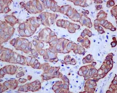 Immunohistochemistry (Formalin/PFA-fixed paraffin-embedded sections) - Anti-TMEM161A antibody [EPR14369] (AB180954)