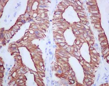 Immunohistochemistry (Formalin/PFA-fixed paraffin-embedded sections) - Anti-TMEM161A antibody [EPR14369] - BSA and Azide free (AB250284), expandable thumbnail