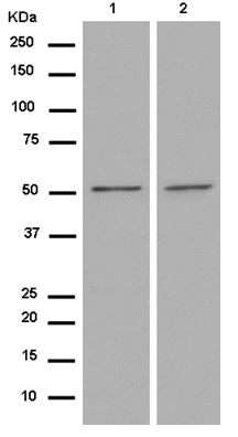 Western blot - Anti-TMEM161A antibody [EPR14369] - BSA and Azide free (AB250284), expandable thumbnail