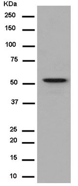 Western blot - Anti-TMEM161A antibody [EPR14369] - BSA and Azide free (AB250284), expandable thumbnail