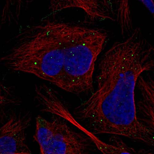 Immunocytochemistry/ Immunofluorescence - Anti-TMEM164 antibody (AB122510)