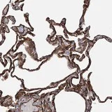 Immunohistochemistry (Formalin/PFA-fixed paraffin-embedded sections) - Anti-TMEM164 antibody (AB122510)
