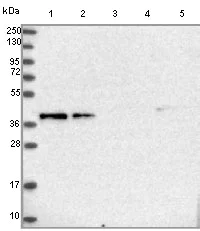 Western blot - Anti-TMEM164 antibody (AB122510)