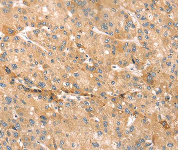 Immunohistochemistry (Formalin/PFA-fixed paraffin-embedded sections) - Anti-TMEM166 antibody (AB216043), expandable thumbnail