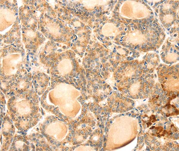 Immunohistochemistry (Formalin/PFA-fixed paraffin-embedded sections) - Anti-TMEM166 antibody (AB216043), expandable thumbnail