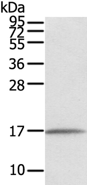 Western blot - Anti-TMEM166 antibody (AB216043), expandable thumbnail