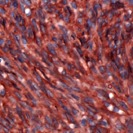 Immunohistochemistry (Formalin/PFA-fixed paraffin-embedded sections) - Anti-TMEM16A antibody (AB53212), expandable thumbnail