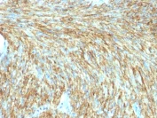 Immunohistochemistry (Formalin/PFA-fixed paraffin-embedded sections) - Anti-TMEM16A antibody [DG1/1487R] - BSA and Azide free (AB218942)