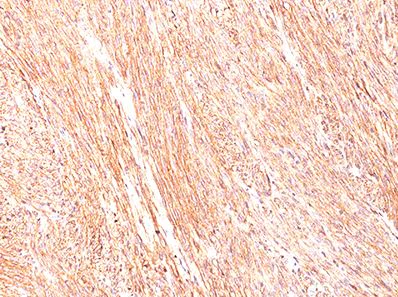 Immunohistochemistry (Formalin/PFA-fixed paraffin-embedded sections) - Anti-TMEM16A antibody [DG1/447] (AB190721)
