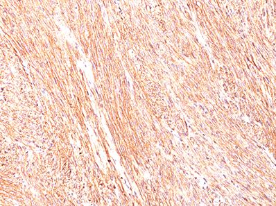 Immunohistochemistry (Formalin/PFA-fixed paraffin-embedded sections) - Anti-TMEM16A antibody [DG1/447] - BSA and Azide free (AB269799)